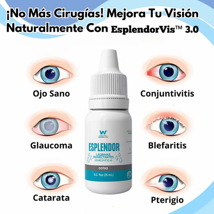 EsplendorVis™ 3.0👁️ | VE EL MUNDO CON CLARIDAD TOTAL.