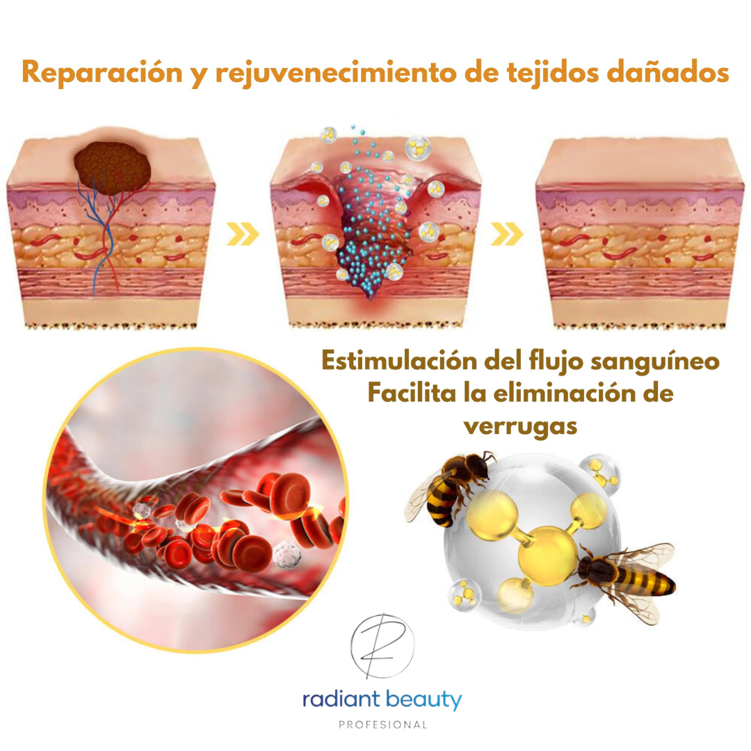 Tagrecede™ | Elimina las verrugas de forma natural